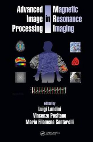 Cover image for Advanced Image Processing in Magnetic Resonance Imaging