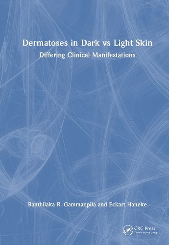 Cover image for Dermatoses in Dark Vs Light Skin