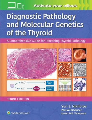 Diagnostic Pathology and Molecular Genetics of the Thyroid: A Comprehensive Guide for Practicing Thyroid Pathology