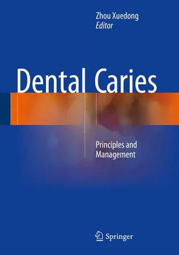 Cover image for Dental Caries: Principles and Management