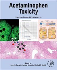 Cover image for Acetaminophen Toxicity