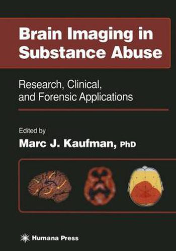 Cover image for Brain Imaging in Substance Abuse: Research, Clinical, and Forensic Applications