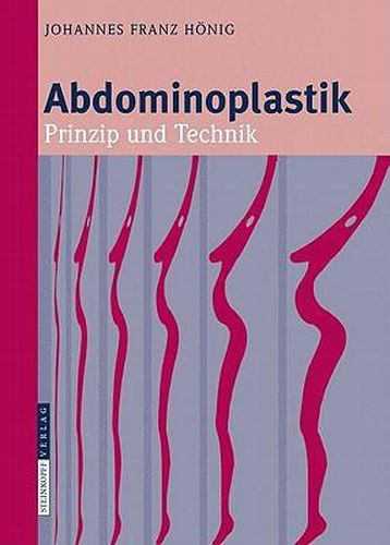 Cover image for Abdominoplastik: Prinzip und Technik
