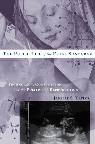 Cover image for The Public Life of the Fetal Sonogram: Technology, Consumption, and the Politics of Reproduction