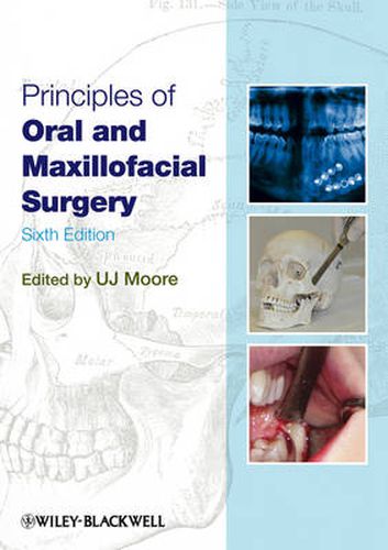 Cover image for Principles of Oral and Maxillofacial Surgery