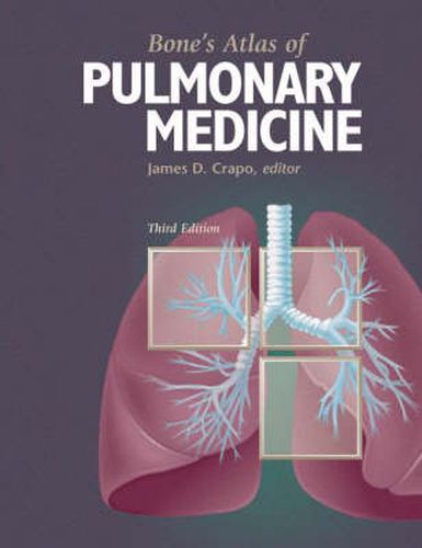 Bone's Atlas of Pulmonary Medicine