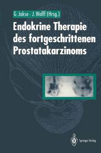 Cover image for Endokrine Therapie des fortgeschrittenen Prostatakarzinoms