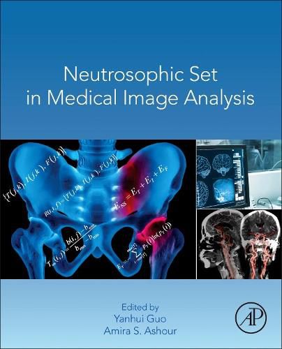 Cover image for Neutrosophic Set in Medical Image Analysis