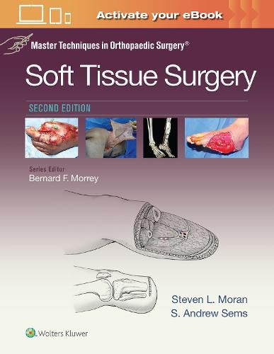 Cover image for Master Techniques in Orthopaedic Surgery: Soft Tissue Surgery