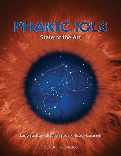 Cover image for Phakic IOLs: State of the Art