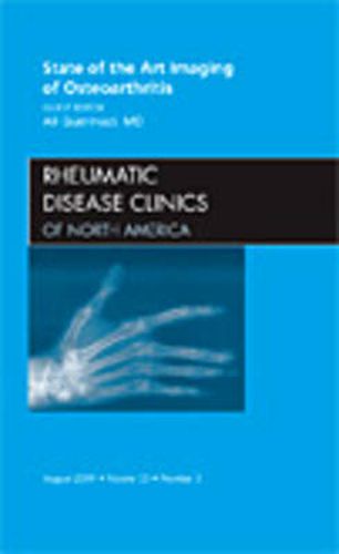 Cover image for State of the Art Imaging of Osteoarthritis, An Issue of Rheumatic Disease Clinics