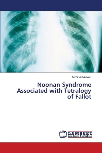 Cover image for Noonan Syndrome Associated with Tetralogy of Fallot