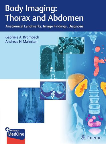 Cover image for Body Imaging: Thorax and Abdomen: Anatomical Landmarks, Image Findings, Diagnosis