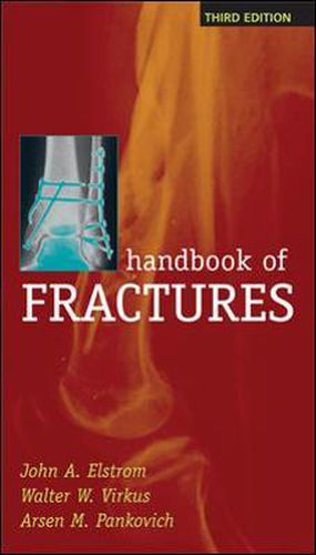 Cover image for Handbook of Fractures, Third Edition