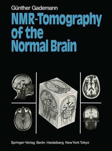 Cover image for NMR-Tomography of the Normal Brain