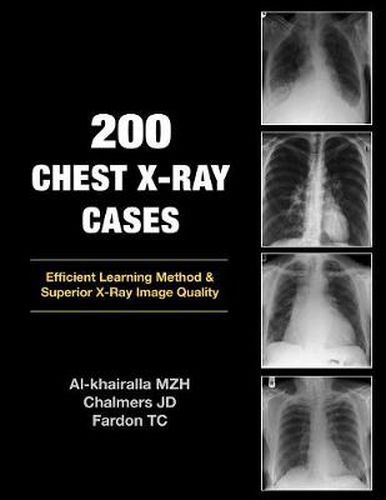 200 Chest X-Ray Cases