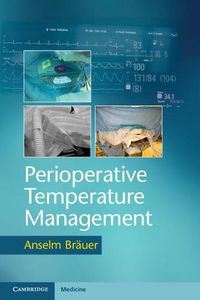 Cover image for Perioperative Temperature Management