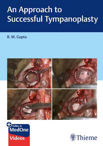 Cover image for An Approach to Successful Tympanoplasty