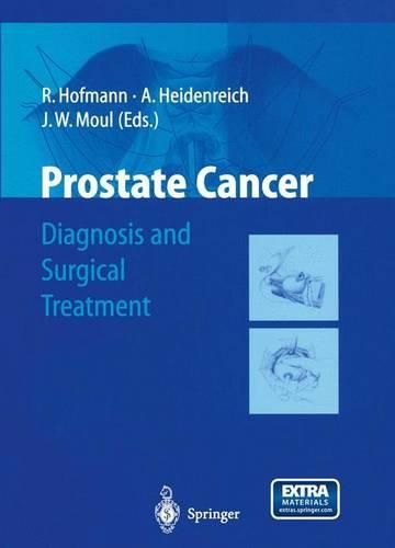 Cover image for Prostate Cancer: Diagnosis and Surgical Treatment