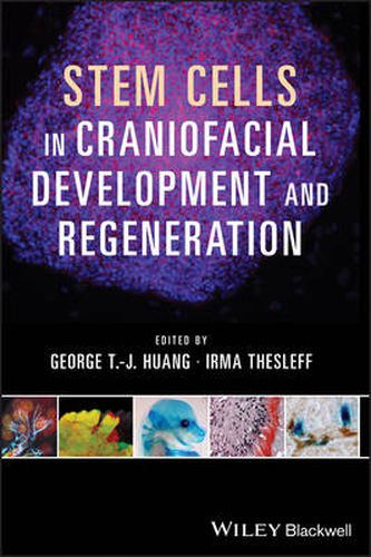 Cover image for Stem Cells in Craniofacial Development and Regeneration