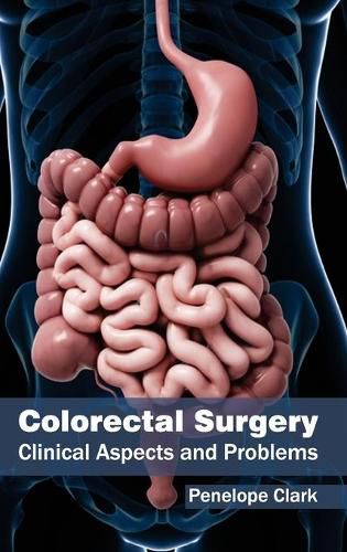 Cover image for Colorectal Surgery: Clinical Aspects and Problems
