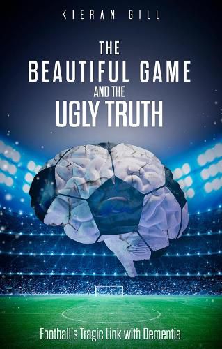 Cover image for The Beautiful Game and the Ugly Truth: Football's Tragic Link with Dementia