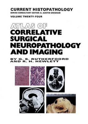 Cover image for Atlas of Correlative Surgical Neuropathology and Imaging