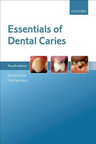 Cover image for Essentials of Dental Caries