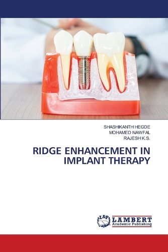 Cover image for Ridge Enhancement in Implant Therapy