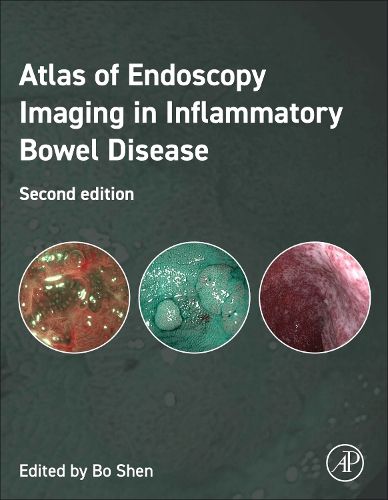 Cover image for Atlas of Endoscopy Imaging in Inflammatory Bowel Disease
