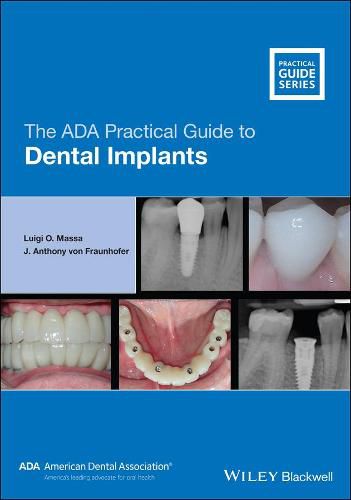 Cover image for The ADA Practical Guide to Dental Implants