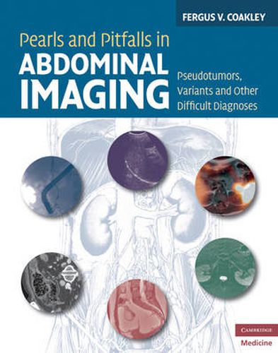 Cover image for Pearls and Pitfalls in Abdominal Imaging: Pseudotumors, Variants and Other Difficult Diagnoses