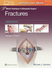 Cover image for Master Techniques in Orthopaedic Surgery: Fractures