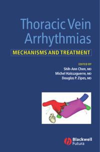 Cover image for Thoracic Vein Arrhythmias: Mechanisms and Treatment