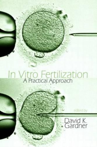 Cover image for In Vitro Fertilization: A Practical Approach