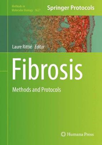 Fibrosis: Methods and Protocols