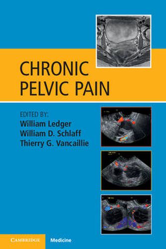 Cover image for Chronic Pelvic Pain