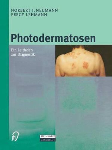 Cover image for Photodermatosen: Ein Leitfaden zur Diagnostik