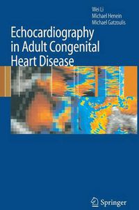 Cover image for Echocardiography in Adult Congenital Heart Disease