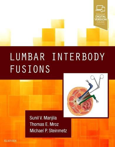 Lumbar Interbody Fusions