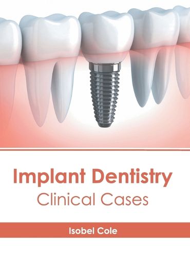 Cover image for Implant Dentistry: Clinical Cases