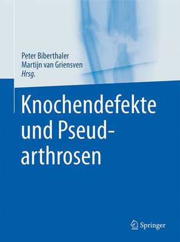 Cover image for Knochendefekte und Pseudarthrosen