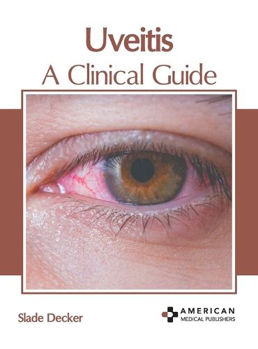 Cover image for Uveitis: A Clinical Guide