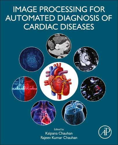 Cover image for Image Processing for Automated Diagnosis of Cardiac Diseases