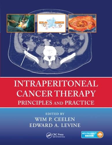 Cover image for Intraperitoneal Cancer Therapy: Principles and Practice