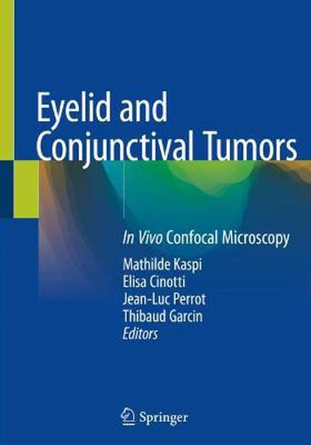 Cover image for Eyelid and Conjunctival Tumors: In Vivo Confocal Microscopy