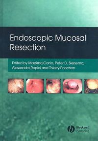 Cover image for Endoscopic Mucosal Resection