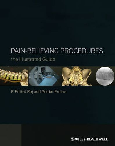 Cover image for Pain-relieving Procedures: The Illustrated Guide