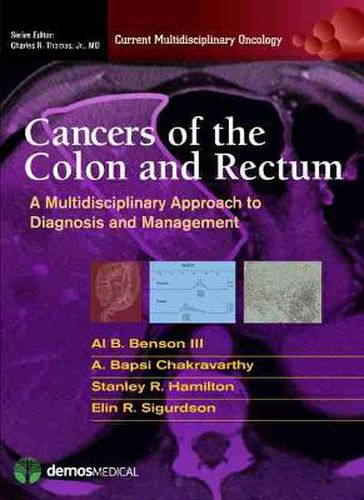 Cover image for Cancers of the Colon and Rectum: A Multidisciplinary Approach to Diagnosis and Management