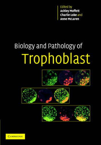 Cover image for Biology and Pathology of Trophoblast